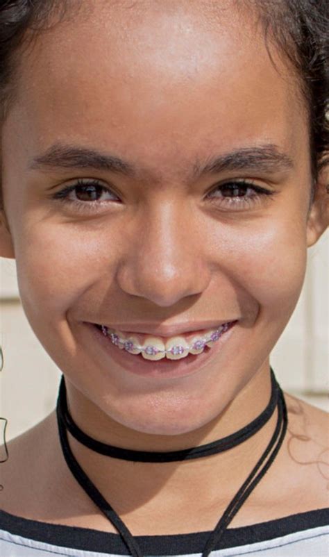 brace face nude|braceface Search